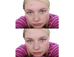 Spot Healing Photoshop Editing Projects :: Photos, videos, logos,  illustrations and branding :: Behance