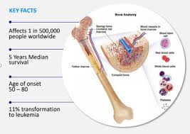 Yellow bone marrow stores fatty tissue. Pharmaxis Discoveries Showing Promise In Bone Marrow Cancer According To Boston University School Of Medicine Publication