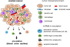 In case the cancer is detected at the ovarian stage (when the disease is confined to the ovary), treatment is more easy and successful. Circulating Mirnas Derived From Ovarian Cancer Ovarian Download Scientific Diagram
