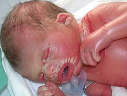 The Pan African Medical Journal Image Quiz