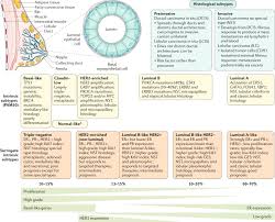 Most breast cancers are found in women who are 50 years old or older. Breast Cancer Nature Reviews Disease Primers