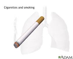 Doctor says i have to quit smoking before he will do the surgery. Tips On How To Quit Smoking Medlineplus Medical Encyclopedia