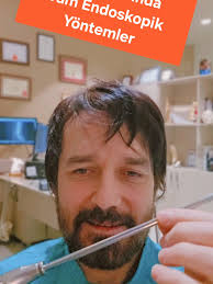 Hakan Erdoğan (@hakanerdoganmd)