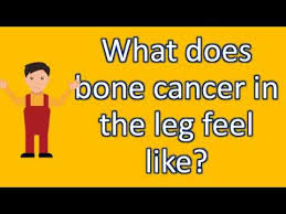 Cancer cells also do not mature and develop to perform highly specialized functions as normal cells do. What Does Bone Cancer In The Leg Feel Like Faqs On Health Youtube