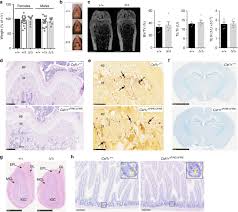 Check spelling or type a new query. Deletion Of A Csf1r Enhancer Selectively Impacts Csf1r Expression And Development Of Tissue Macrophage Populations Nature Communications