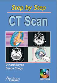 Step By Step Ct Scan A Practical Guide For Residents And Technologists Amazon Com Br