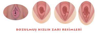 Bozulmus Kizlik Zari Resimleri Resim Zara