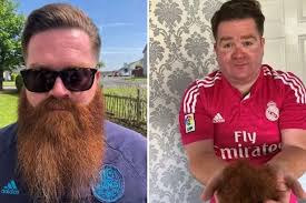 East Kilbride fundraiser shaves off eight-inch beard in aid of dementia  care group