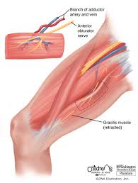 Muscles of the leg and foot. Facial Nerve Reconstruction For Facial Paralysis St Louis Childrens Hospital