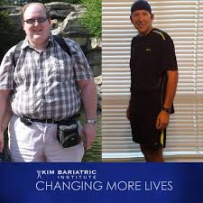 Pin On Bariatric Inspiration Weight Loss Stories Recipes