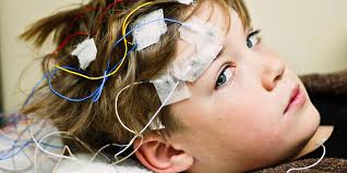 Toda la información sobre síntomas, causas, tratamientos y diagnósticos. Sindromul Dravet Sfatul Miculrinocer Ro