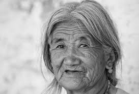 Novel Influenza A H1N1