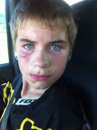 Great news, Manxman Anthony Redmond has finally made it home from hospital.  7 weeks after a crash in a warm up lap for this year's superbike race, left  him with serious injuries,