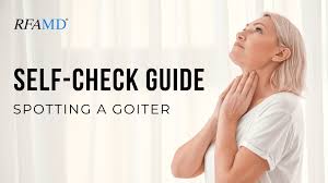 Image result for Goiter