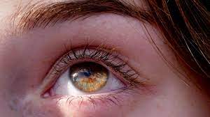 How To Fix A Lazy Eye Treatment Strategies
