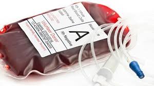 Image result for Plasma Transfusion