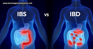 IBS and IBD