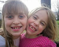 Snapz: Toothless Grins Photo Gallery