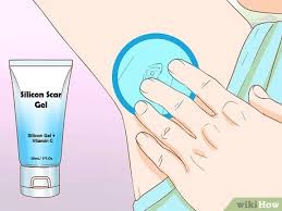 3 Simple Ways To Get Rid Of Boil Scars Wikihow 3 simple ways to get rid of boil scars