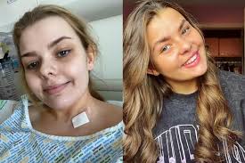 Young Glasgow woman in remission from Hodgkin's Lymphoma thanks cancer  staff two years after diagnosis