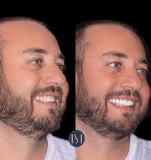 Luiz Marotti (@drluizmarotti) · Instagram 照片和视频