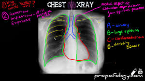 Pin On Critical Care