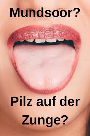 Mundsoor Zungenpilz Pilze Zunge Erste Hilfe