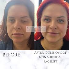 🌟YOGA CLASSES AT WEDGES MILLS VILLAGE HALL 🌟 TUESDAY Chair Yoga