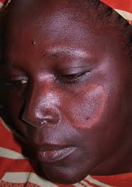 Actualités Tropicales