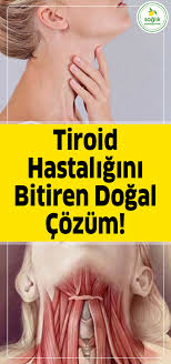 Tiroid Hastaligini Bitiren Dogal Cozum Health Lifestyle Health Fitness Nutrition Thyroid Disease