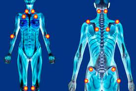 Fibromyalgia is currently understood to be a disorder of central pain processing or a syndrome of central sensitivity. 5 Das Pessoas No Mundo Tem Fibromialgia Sociedade Mineira De Reumatologia