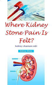 Stage5kidneydisease Chronic Kidney Disease Bone Disorder Ketogenic Diet Kidney Disease Chronickid Kidney Disease Diet Kidney Disease Awareness Renal Disease