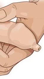 Image result for penis mycosis symptoms