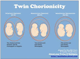 Pin On Twins