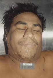 Unclaimed Person in Chicago, Illinois