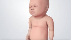 Infant Distress Warning Signs Grunting Baby Sound Youtube