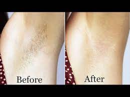This increases the time you must wait and let the hair grow out between waxing. How To Wax Your Underarms Best Way To Get Rid Of Underarm Hair Easy Way To Wax