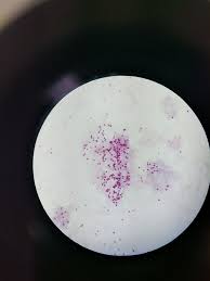 Cryptosporidium parvum is one of several species that cause cryptosporidiosis, a parasitic disease of the mammalian intestinal tract. Protozoa Cryptosporidium Parvum 100x A Coccidia Tableware Kitchen Plates