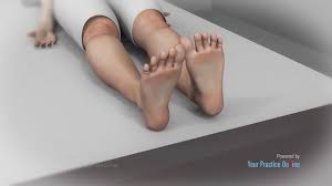 Image result for Restless Leg Syndrome