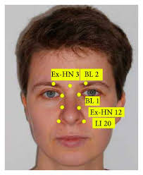 Standardised Point Chart For Facial Acupuncture Download