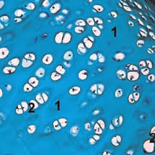 It is also most commonly found in the ribs, nose, larynx, and trachea. Hyaline Cartilage Is Avascular And Aneural Compact Tissue With Abundant Download Scientific Diagram