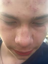 For those that could not make it or watch the livestream. Our case is at  about the 1:22 minute mark. The right side of the Court Room was filled  with State sponsored