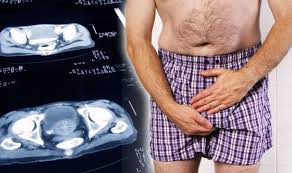 Prostate cancer symptoms can often be mistaken for an enlarged prostate and signs don't usually show until the cancer has grown. Prostate Cancer Symptoms What Are The Signs How To Check And When To Get The Test Express Co Uk