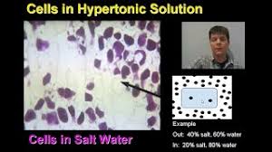 Check spelling or type a new query. Plant Cells Become Turgid When Water Enters The Vacuole Is This True Socratic