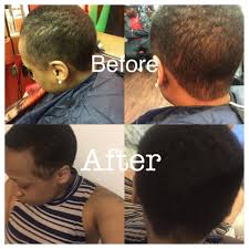 About seven years ago, i read the adverts about wild growth hair oil and i was quite impressed hey i used wild growth oil april of 2018 no side effects but my friend lost the bottle so i purchased a new one on june 22 2018. Wild Growth Hair Oil Do The Results Match The Hype Best Hair Growth Vitamins