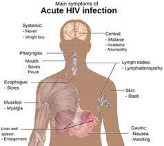 Can hiv patients have a hair transplant? Hiv And Chronic Hepatitis B Drug May Cause Hair Loss