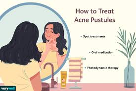 Image result for Pustule