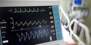 Ia juga biasa disebut nadi. Cara Membaca Ekg Saat Mengecek Kondisi Jantung Perhatikan Setiap Langkah Langkahnya Merdeka Com