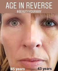 What is the best treatment for reversing facial aging after weight loss?