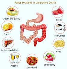 Oatmeal also contributes to a healthy bowel function and helps relieve constipation. Foods To Avoid In Ulcerative Colitis By Dt Neha Suryawanshi Lybrate